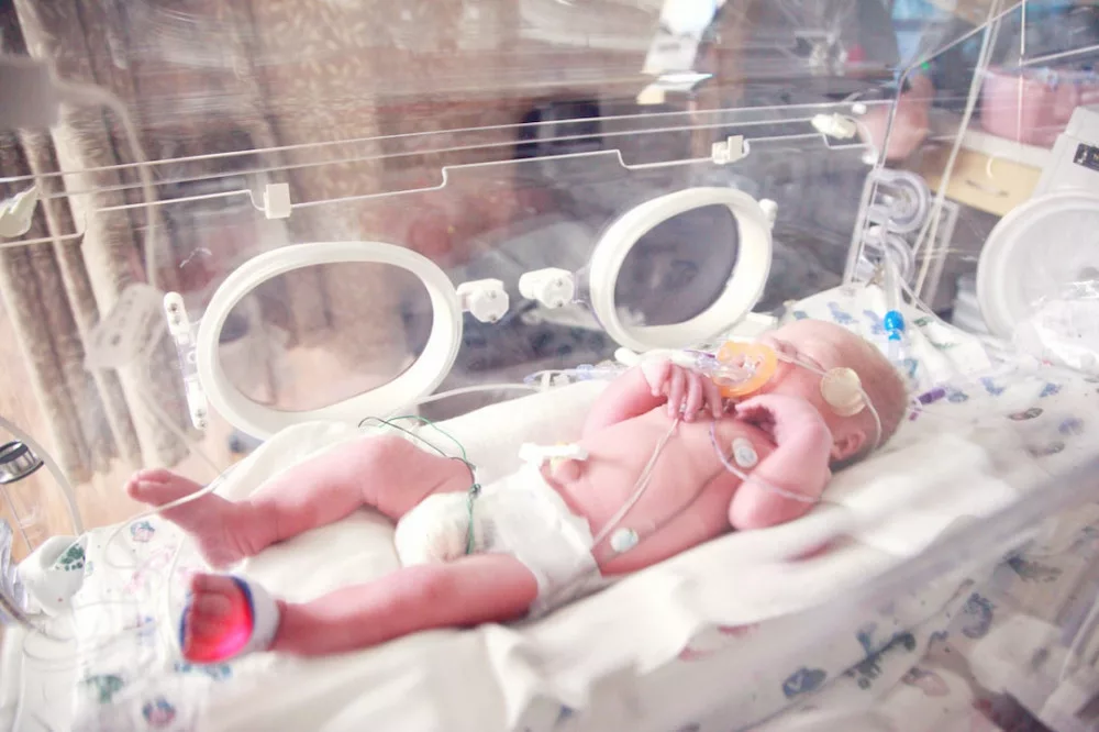 Read more about the article Feeding Issues of Premature Babies